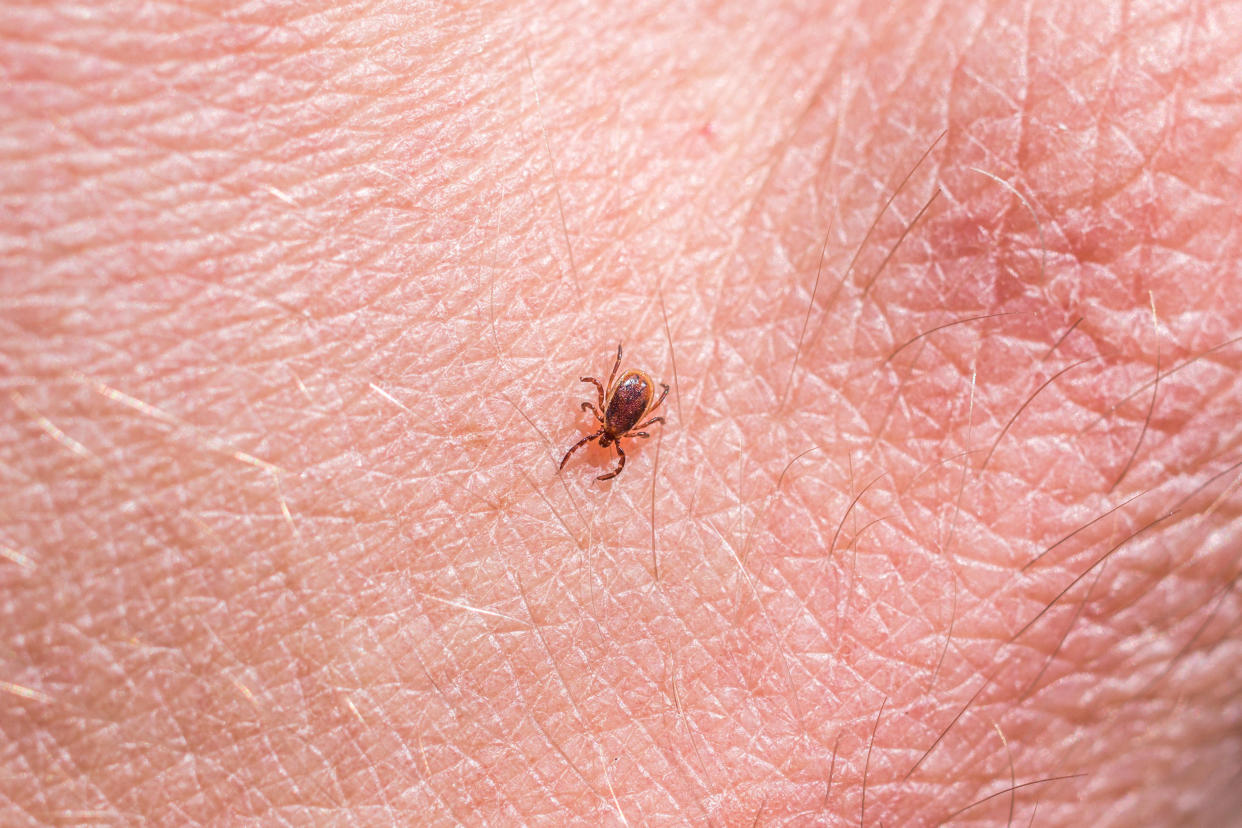 A deer tick or black-legged tick (Ixodes scapularis) crawling on skin. (Alamy Stock Photo)