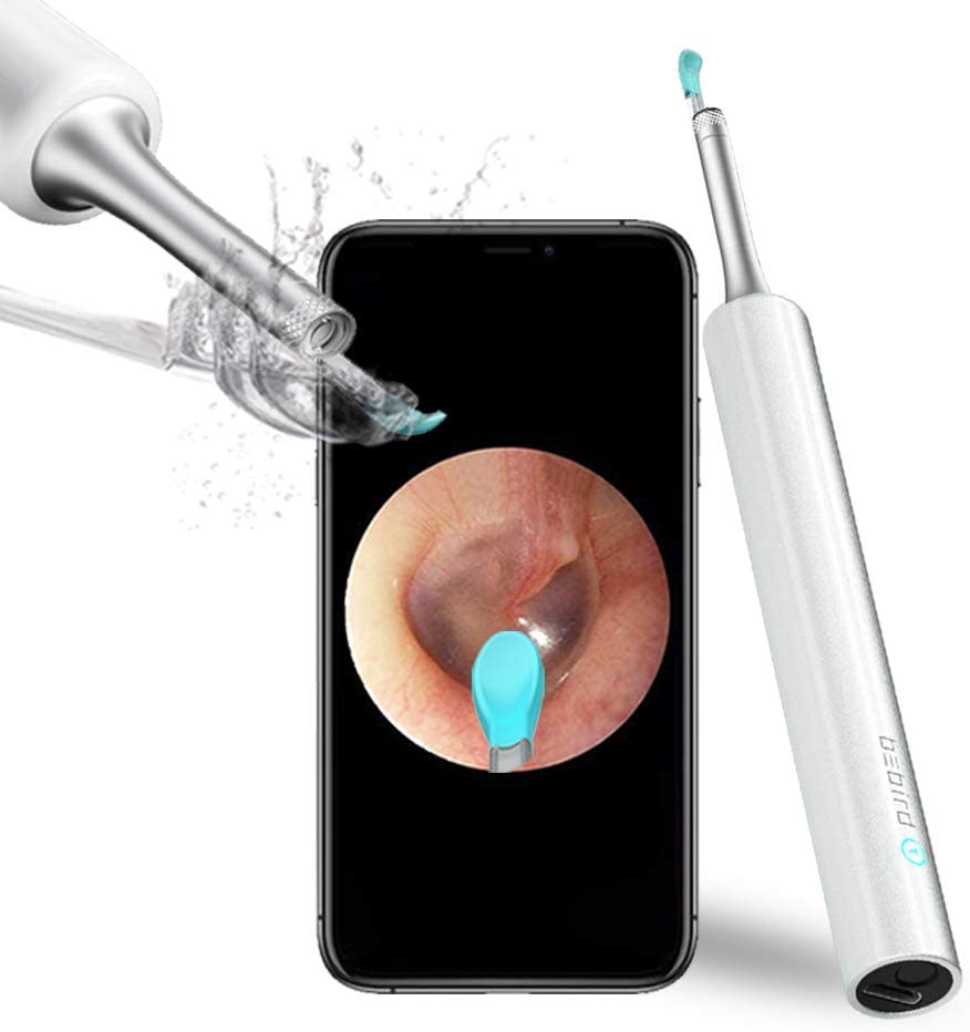 BEBIRD Ear Wax Removal Endoscope