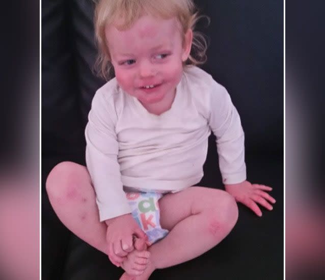 The toddler now faces a 12-month wait to have a proper diagnosis of his condition. Source: GoFundMe/ Chelsea Jenkins