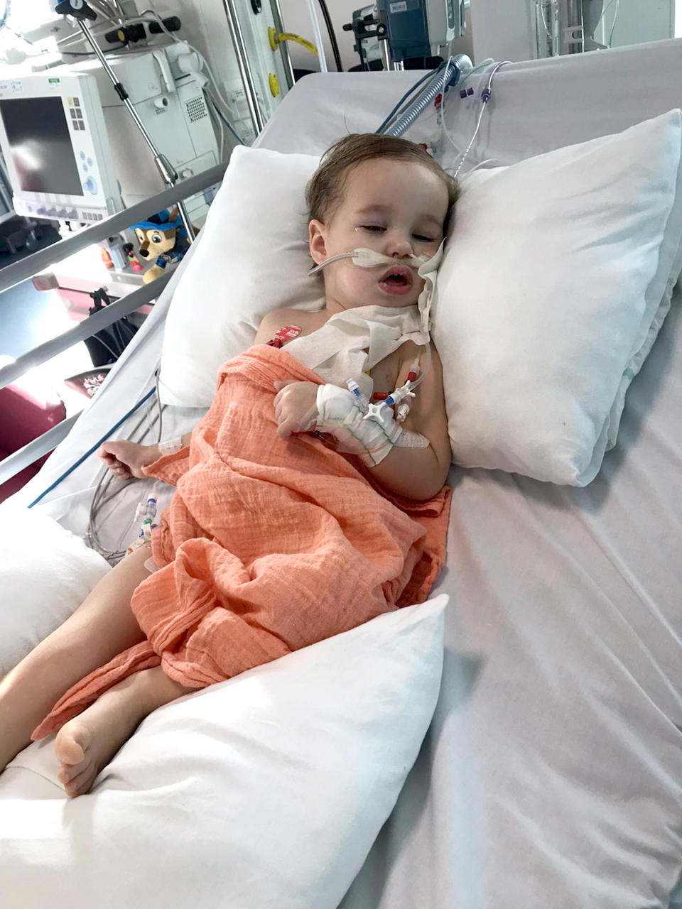 Little Alex had an operation to remove 90% of the tumour and is now having chemotherapy (Caters)