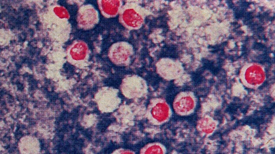 Microscopic view of parasite cryptosporidium germ, that causes severe diarrhoea in children & is known as cryptosporidiosis disease, 12/03/98.\nMedical