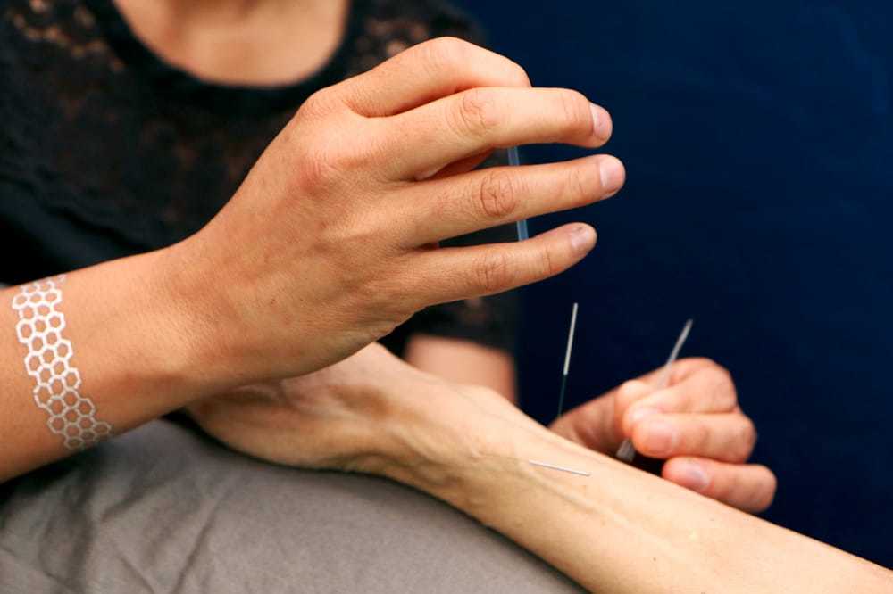 <p>Photo: Berkeley Community Acupuncture/<a href="https://www.yelp.com/biz_photos/berkeley-community-acupuncture-berkeley-5?select=G2A2bbJnAMpz_vzbx_eX0A&utm_campaign=ad5b2e0a-67fc-4c4e-a29e-ea5522b33006%2Ca4f82d26-64f9-4f88-982e-4ab43df0acd6&utm_medium=81024472-a80c-4266-a0e5-a3bf8775daa7" rel="nofollow noopener" target="_blank" data-ylk="slk:Yelp;elm:context_link;itc:0;sec:content-canvas" class="link ">Yelp</a></p>