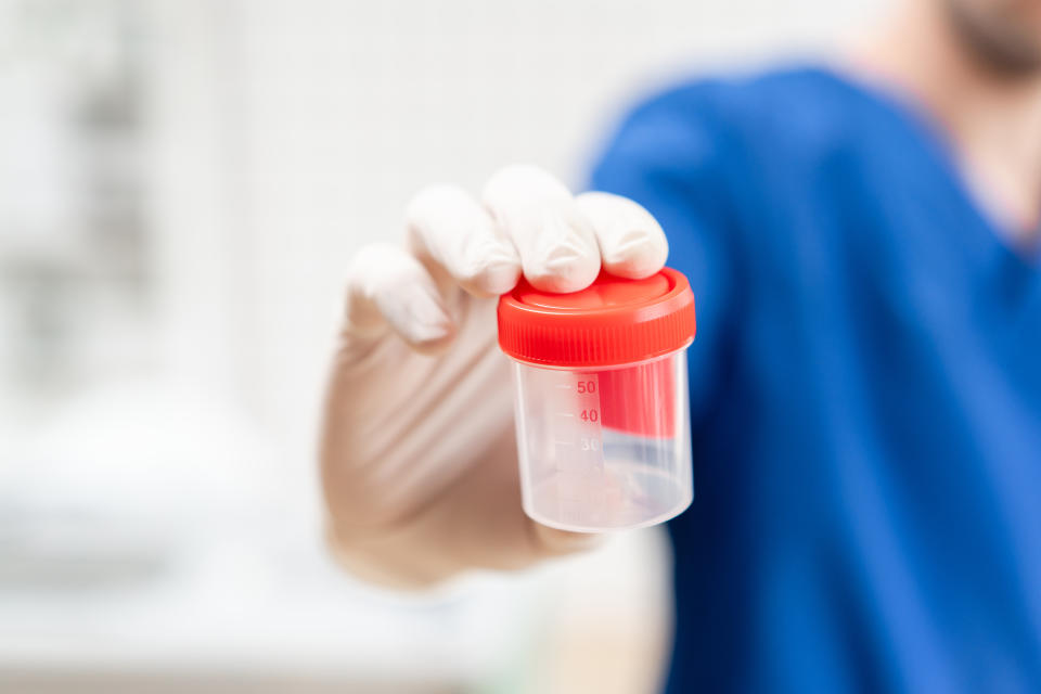 doctor in blue uniform and latex gloves is holding an empty plastic container for taking urine samples, light background