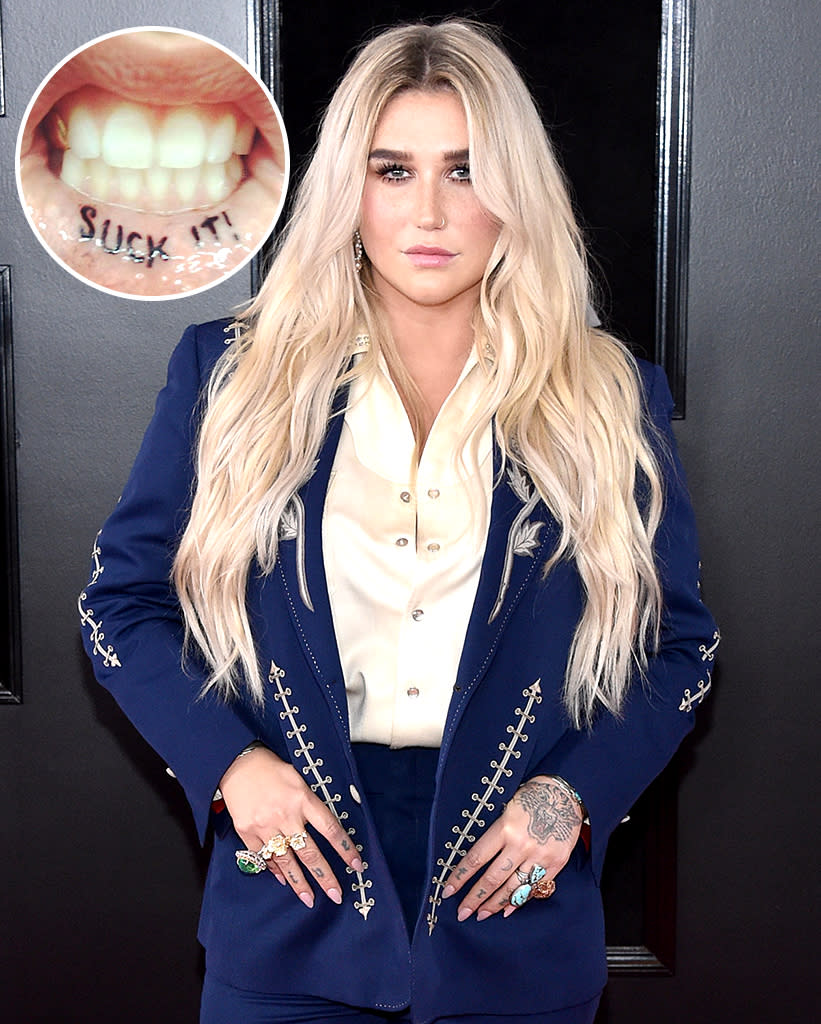 Kesha's lip tattoo just looks painful. (Photo: Kesha via Instagram/Getty Images)