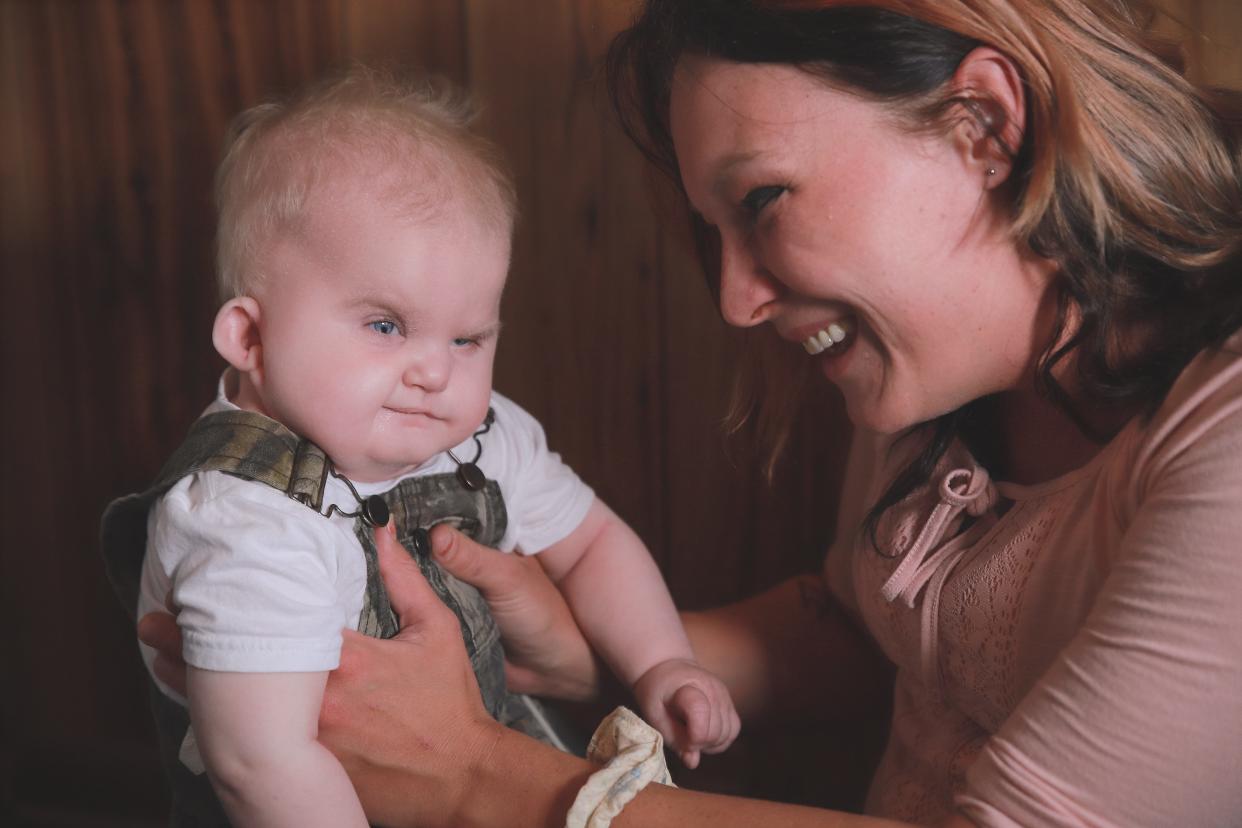 Hunter Bruton, now age 2, has CHARGE syndrome. He does not have a thymus and, consequently, no immune system. He is on Duke University's wait list to have a thymus transplant. He is pictured here with his mom, Victoria Parker.