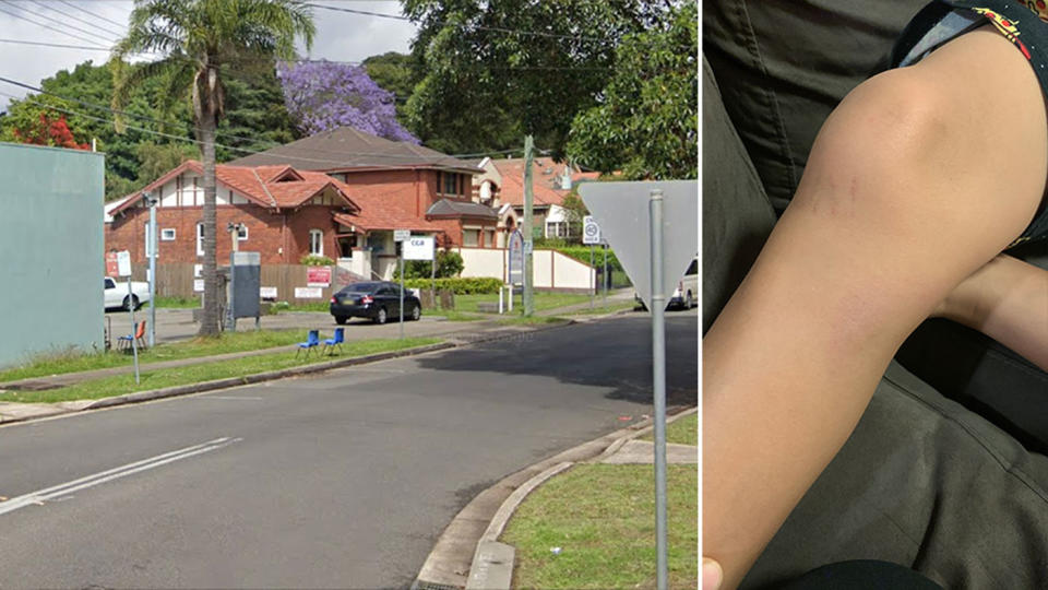 The incident happened on Dickson Avenue in West Ryde, and the boy had some bruising following the fall. Source: Google Maps/Supplied