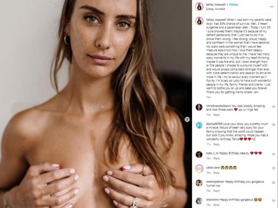 Tahlia revealed on her 30th birthday she had been given only a 30 per cent chance of survival at birth. Picture: Instagram