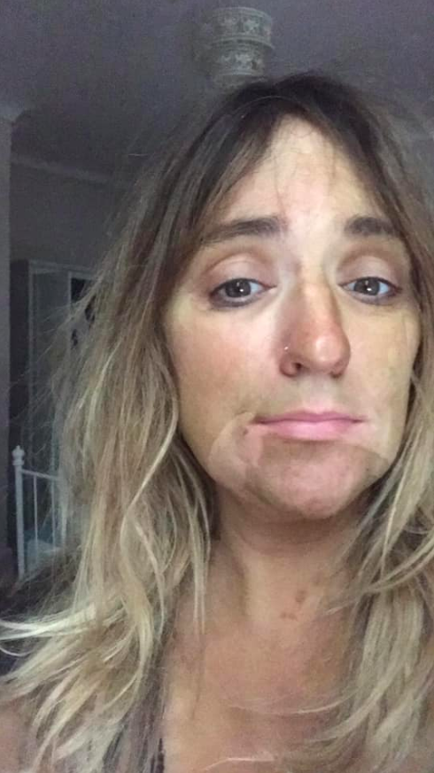 Woman's self-tan fail leaves her too embarrassed to leave her home