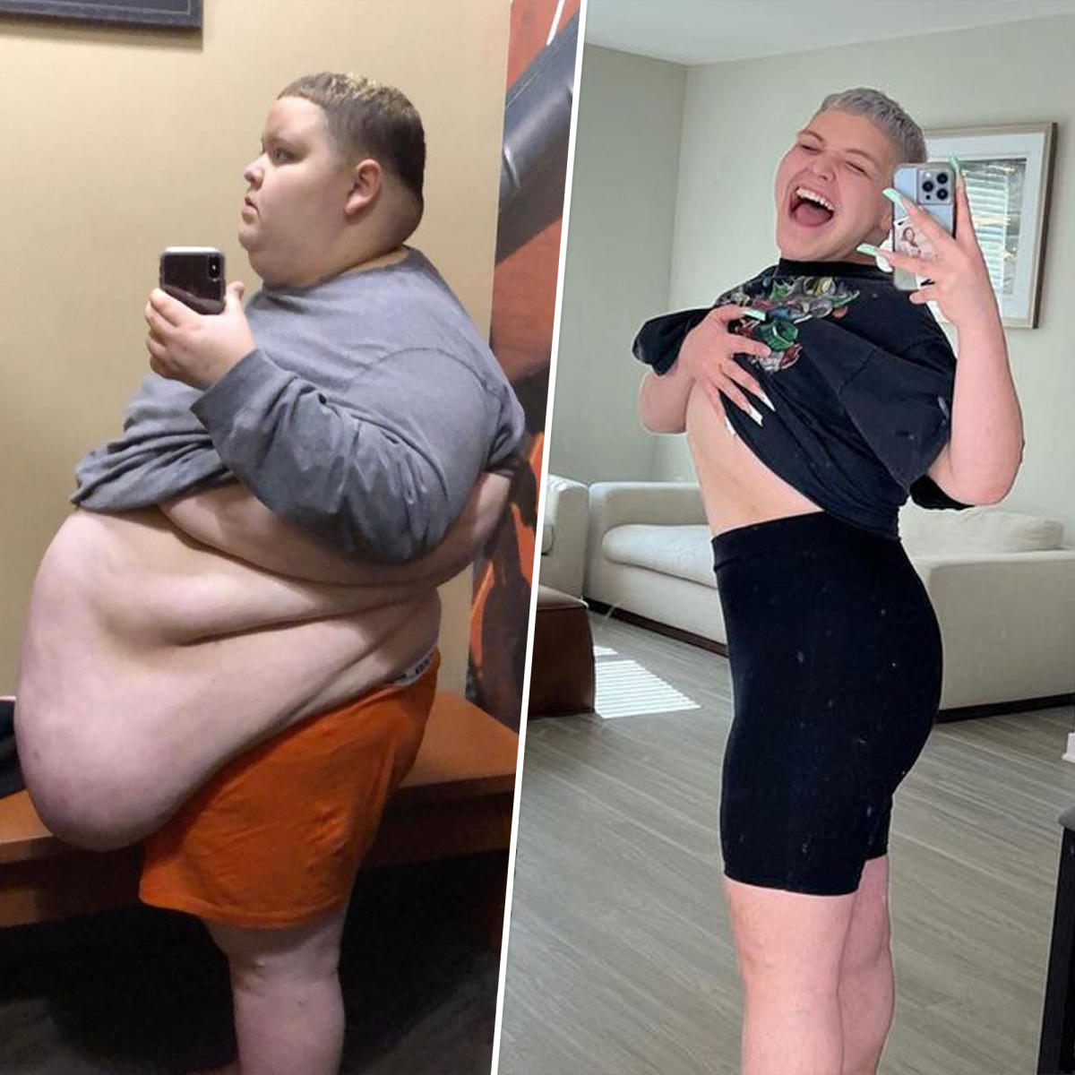 Viral TikTok star opens up about 200-pound weight loss and skin