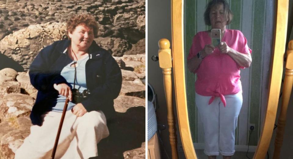 Dimmer says her weight loss has been 'life changing' pictured before and after her weight loss. (Caters) 