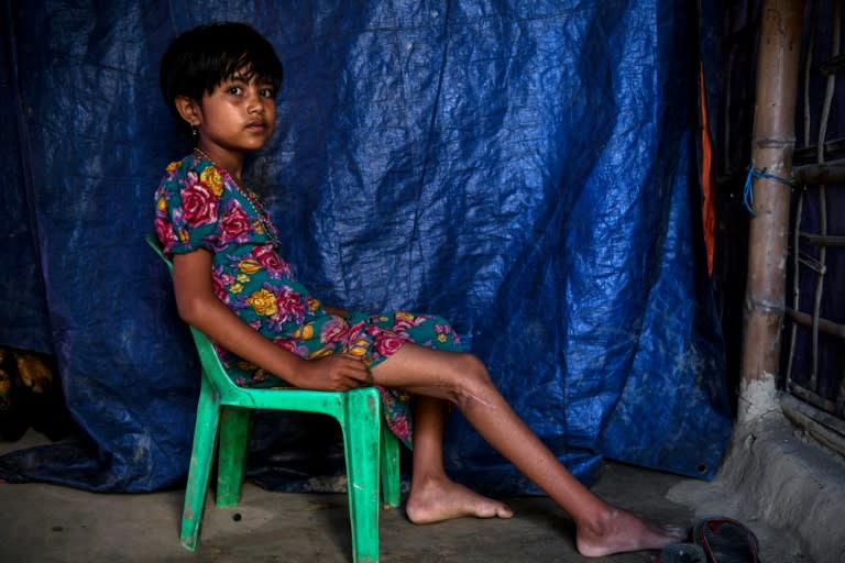Rohingya refugee Minara, 8, cannot walk properly after being shot in the back of the knee