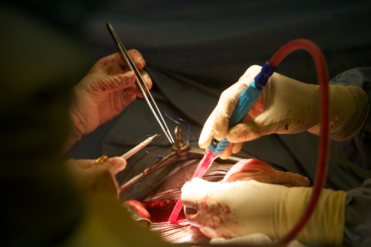 Surgeons operating on a patient.