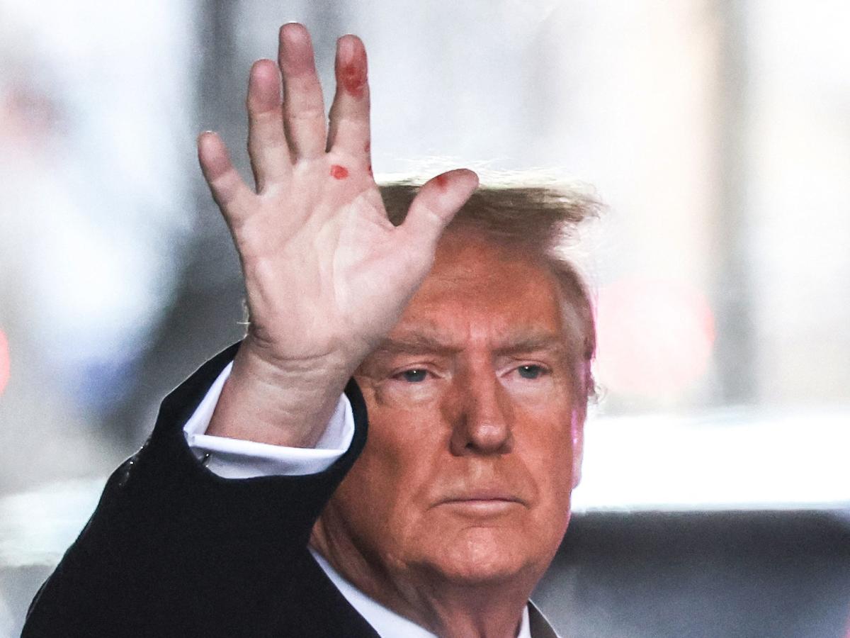 Доналд Тръмп показа мистериозни червени петна по ръката си при