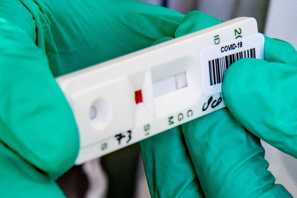 A strip running a coronavirus antibody test on a blood samples.