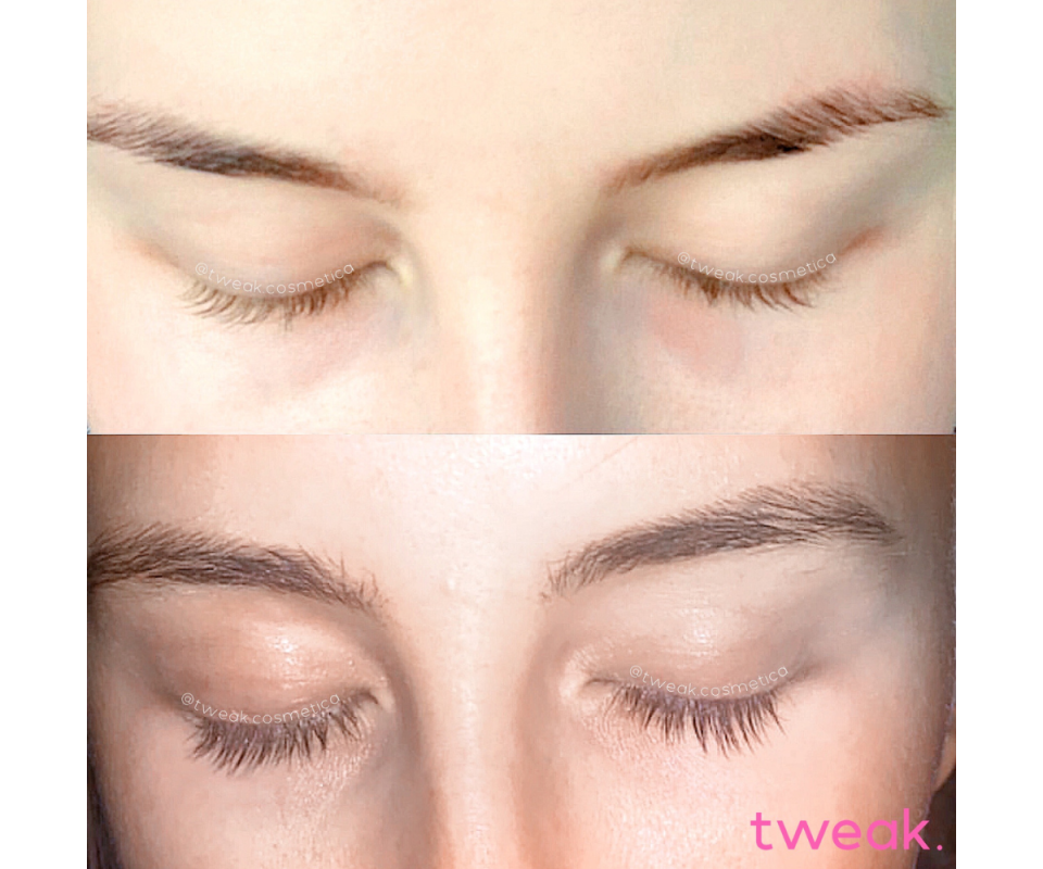 Before and after pictures of a woman's eyelashes, the top image showing short lashes and the bottom image revealing longer, darker lashes.