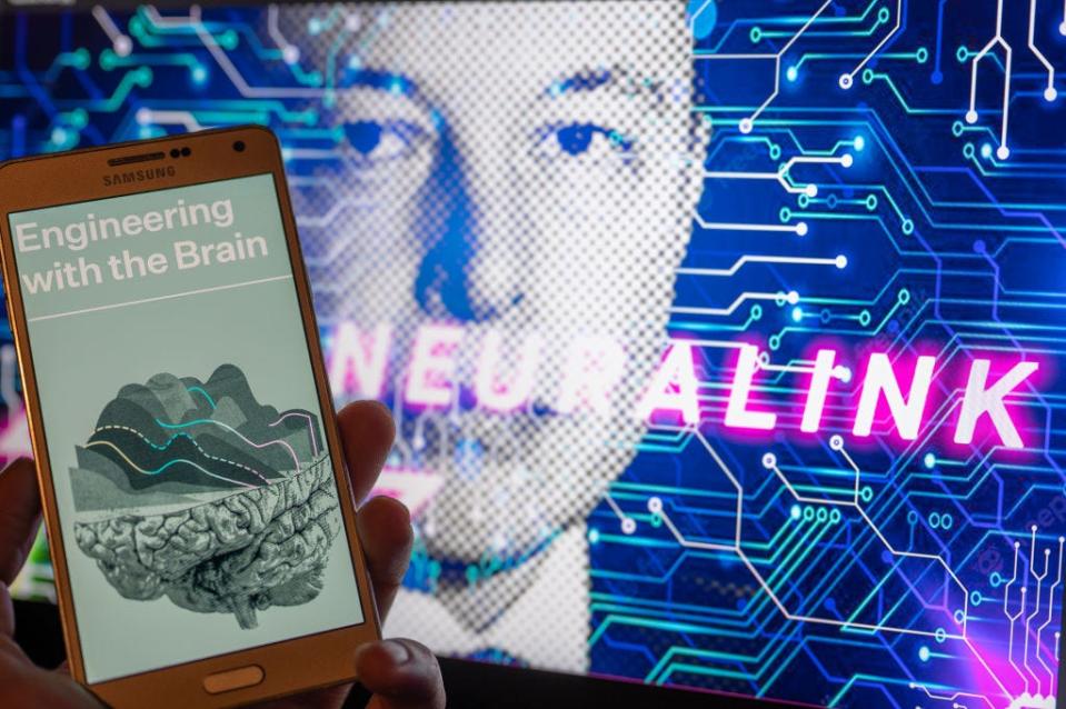 Elon Musk will Menschen mit Neuralink einen Chip ins Gehirn setzen. - Copyright: NurPhoto