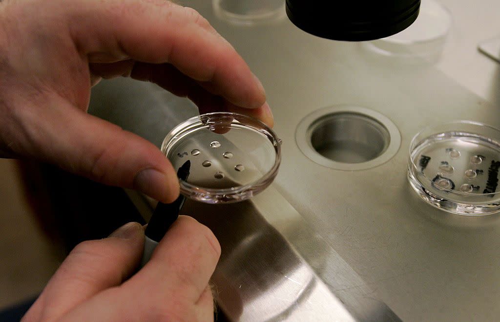 la jolla, ca february 28 embryologist ric ross holds a dish with human embryos at the la jolla ivf clinic february 28, 2007 in la jolla, california the clinic accepts donated embryos from around the country through the stem cell resource which are then given to stem cell research labs for research photo by sandy huffakergetty images