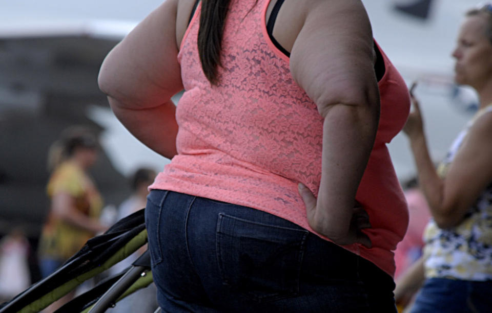<em>Discrimination – surgeons say there is still discrimination when it comes to weight</em>