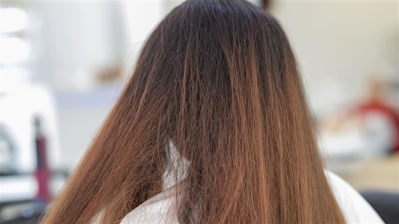 台北榮總表示，頭髮苯巴比妥檢驗開發法進展順利，可望在三個月內完成開發（圖／翻攝自pixabay）