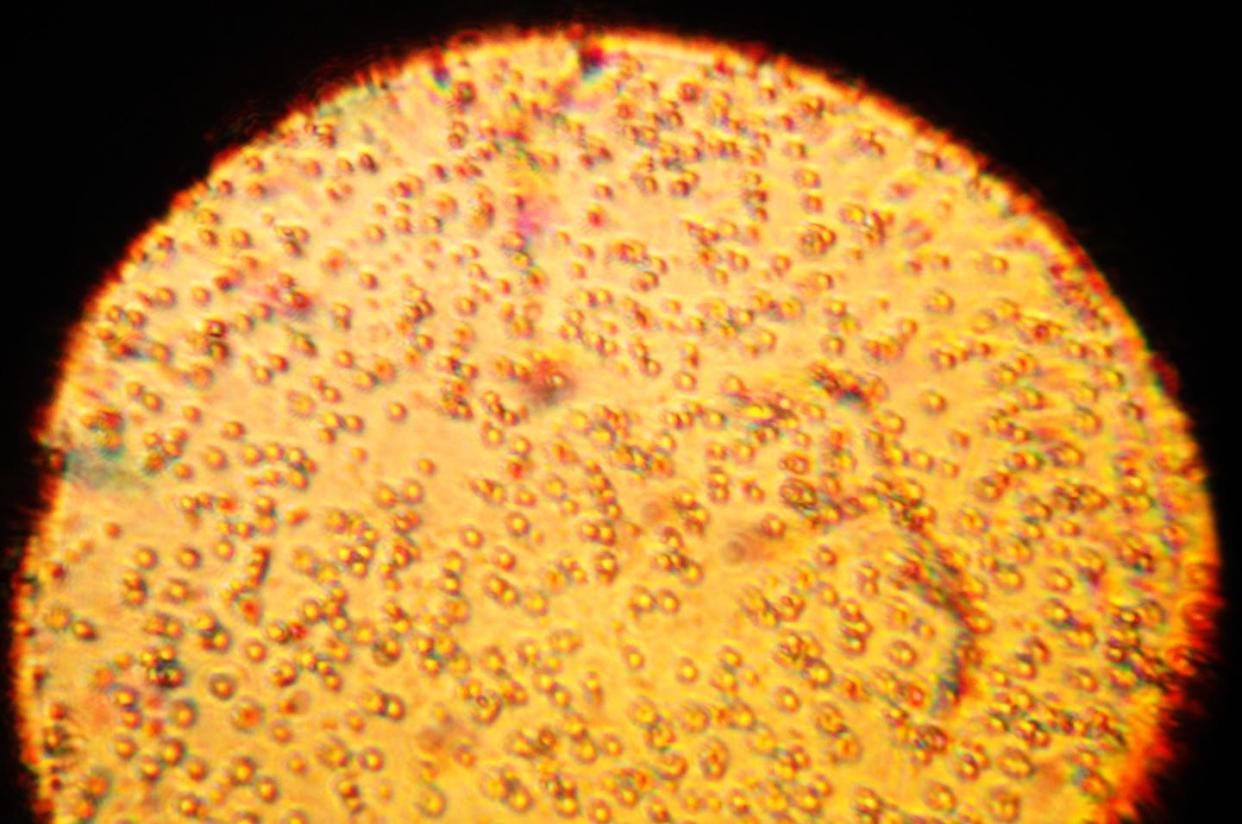 Imagen de leche materna vista con microscopio. <a href="https://commons.wikimedia.org/wiki/File:A_microscopy_image_of_a_sample_of_human_breast_milk.JPG" rel="nofollow noopener" target="_blank" data-ylk="slk:Wikimedia Commons / Amangeldyurazov;elm:context_link;itc:0;sec:content-canvas" class="link ">Wikimedia Commons / Amangeldyurazov</a>, <a href="http://creativecommons.org/licenses/by-sa/4.0/" rel="nofollow noopener" target="_blank" data-ylk="slk:CC BY-SA;elm:context_link;itc:0;sec:content-canvas" class="link ">CC BY-SA</a>