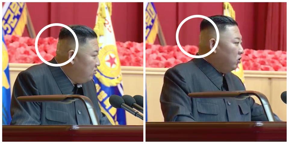 Two side by side images of Kim Jong Un at a July conference, viewed from side on. A visible band aid on the back of his head is circled by Insider.