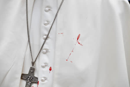 A few droplets of blood stain Pope Francis' white tunic from a bruise around his left eye and eyebrow caused by an accidental hit against the popemobile's window glass while visiting the old sector of Cartagena, Colombia, on September 10, 2017.REUTERS/Alberto PIZZOLI/Pool