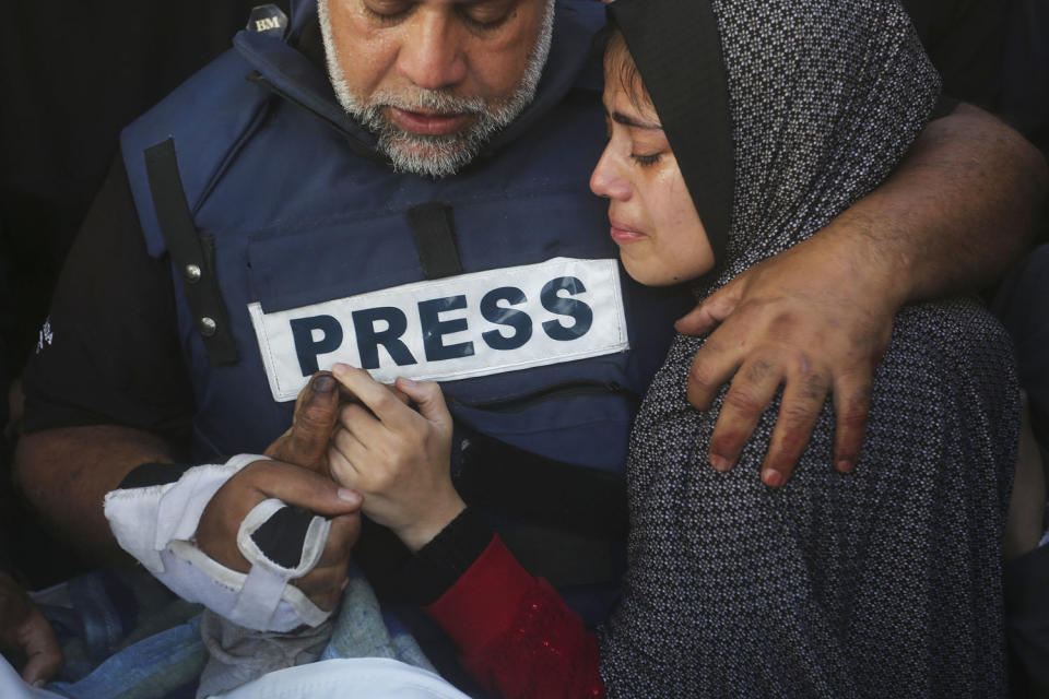 Dahdouh lost his wife, two other children and a grandson earlier in the war and was nearly killed himself.  (Hatem Ali / AP)