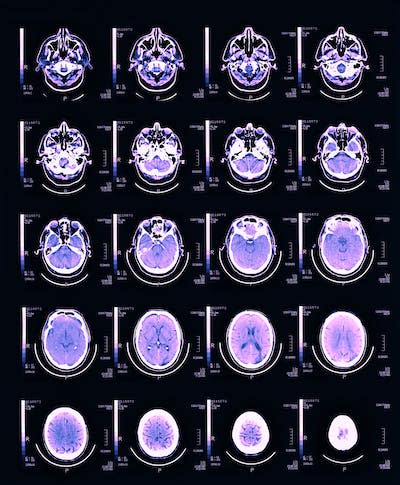 A better understanding of how the brain works could offer insights into human behavior and disease. <a href="https://www.gettyimages.com/detail/photo/brain-scan-close-up-royalty-free-image/sb10069835m-001" rel="nofollow noopener" target="_blank" data-ylk="slk:Peter Dazeley/The Image Bank via Getty Images;elm:context_link;itc:0;sec:content-canvas" class="link ">Peter Dazeley/The Image Bank via Getty Images</a>