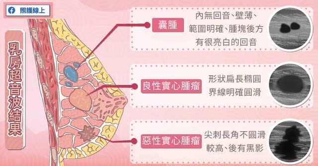  惡性實心腫瘤的特徵