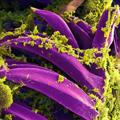 Microscopic view of Yersinia pestis, the bacteria that cause bubonic plague, on a flea. Plague is an example of previous devastating pandemics of bacterial disease. (NIAID), <a href="http://creativecommons.org/licenses/by/4.0/" rel="nofollow noopener" target="_blank" data-ylk="slk:CC BY;elm:context_link;itc:0;sec:content-canvas" class="link ">CC BY</a>