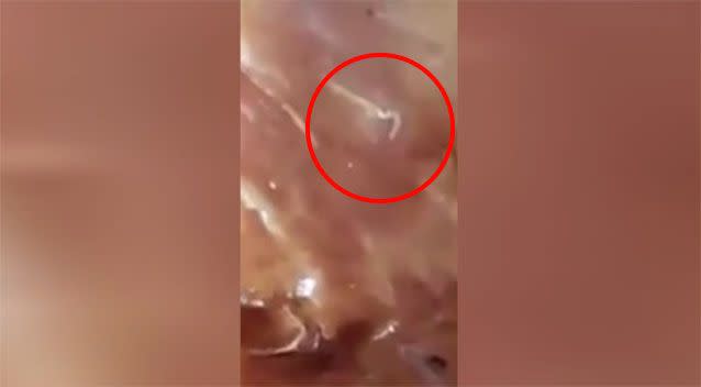 The maggot filmed inside the Coles chicken. Source: Facebook