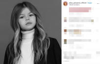 Yakupova è rappresentata dall'agenzia di moda per bambini, President Kids (PK) Management, la stessa che seguiva un'altra giovane modella russa, Anastasia Knyazeva. Quest'ultima si era guadagnata nel 2016, all'età di 6anni, lo scettro di "bambiba più bella del mondo". Prima di loro il titolo era nelle mani della modella francese Thylane Blondeau, figlia del calciatore Patrick Blondeau, che oggi ha 18 anni.