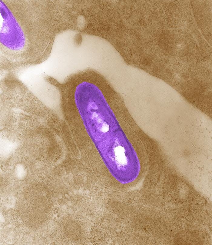 Electron micrograph of a Listeria bacterium in tissue.