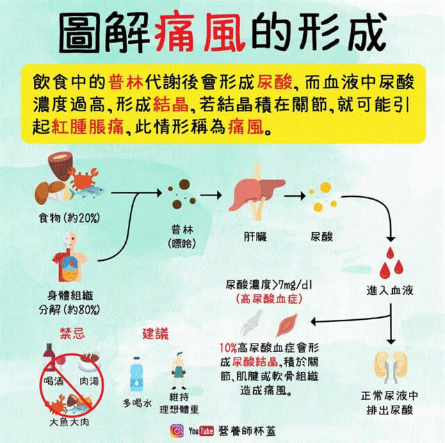 痛風成因