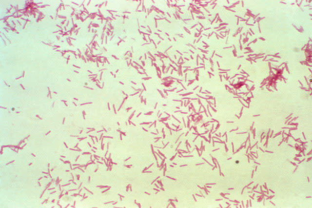 Magnified image of the gram negative bacteria Bacteroides fragilis (Public Health Image Library/PA)