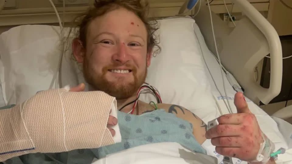 Matt Reum has several broken bones and is grateful for the two fishermen who found him, according to his labor union. - From Haley Traxler