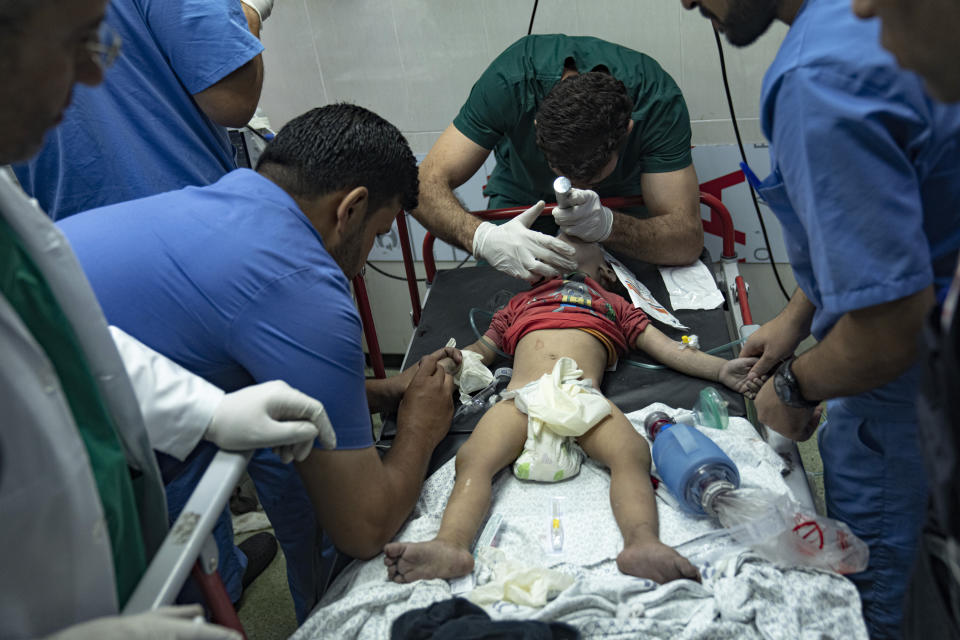 Palestinian medics treat a child wounded in the Israeli bombardment of the Gaza Strip in Khan Younis, Tuesday, Oct. 17, 2023. (AP Photo/Fatima Shbair)