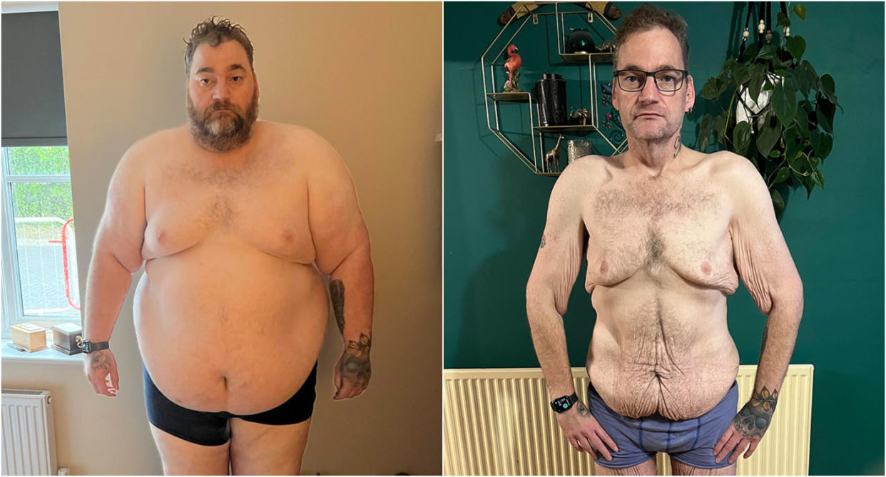 Wayne Shepherd before and after weight loss with excess skin