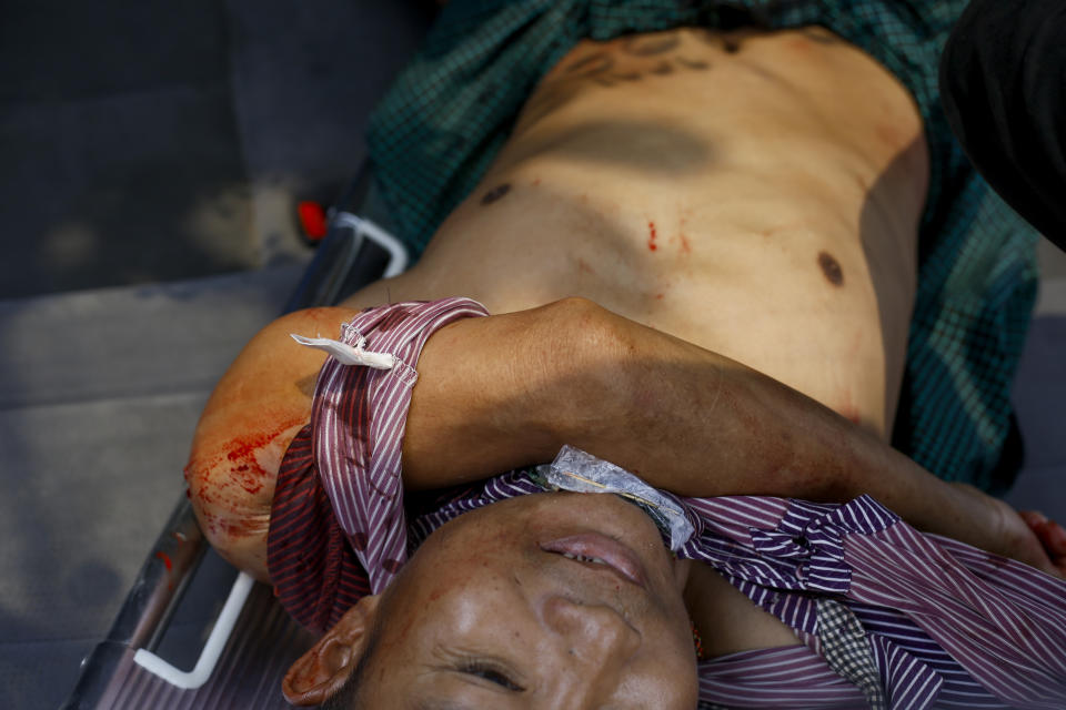 A bleeding anti-coup protester lies on a stretcher after he was shot with rubber bullets by riots policemen during a demonstration in Yangon, Myanmar Sunday, March 14, 2021. The civilian leader of Myanmar’s government in hiding vowed to continue supporting a “revolution” to oust the military that seized power in last month’s coup, as security forces again met protesters with lethal forces, killing several people. (AP Photo)