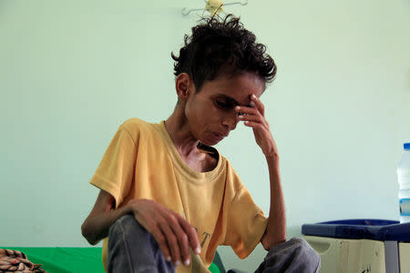 Malnourished Ghazi Ahmad, 10, sits on a bed at a hospital in Taiz, Yemen October 30, 2018. Picture taken October 30, 2018. REUTERS/Anees Mahyoub