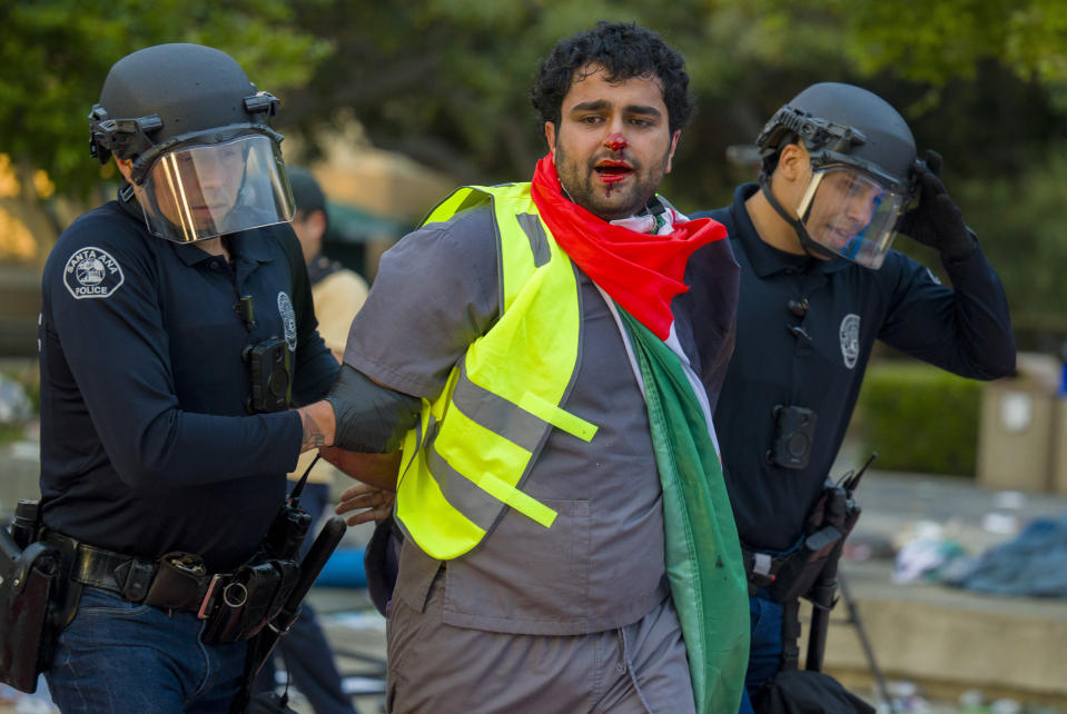 Santa Ana police detain a pro-Palestinian protester during a protest at the University of California, Irvine, Wednesday, May 15, 2024, in Irvine, Calif. (Leonard Ortiz/The Orange County Register via AP)