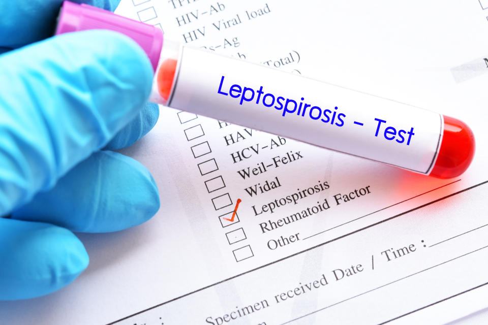 Blood sample tube with laboratory requisition form for Leptospirosis test. Bogoch claimed that Canadians should not be overly concerned about leptospirosis