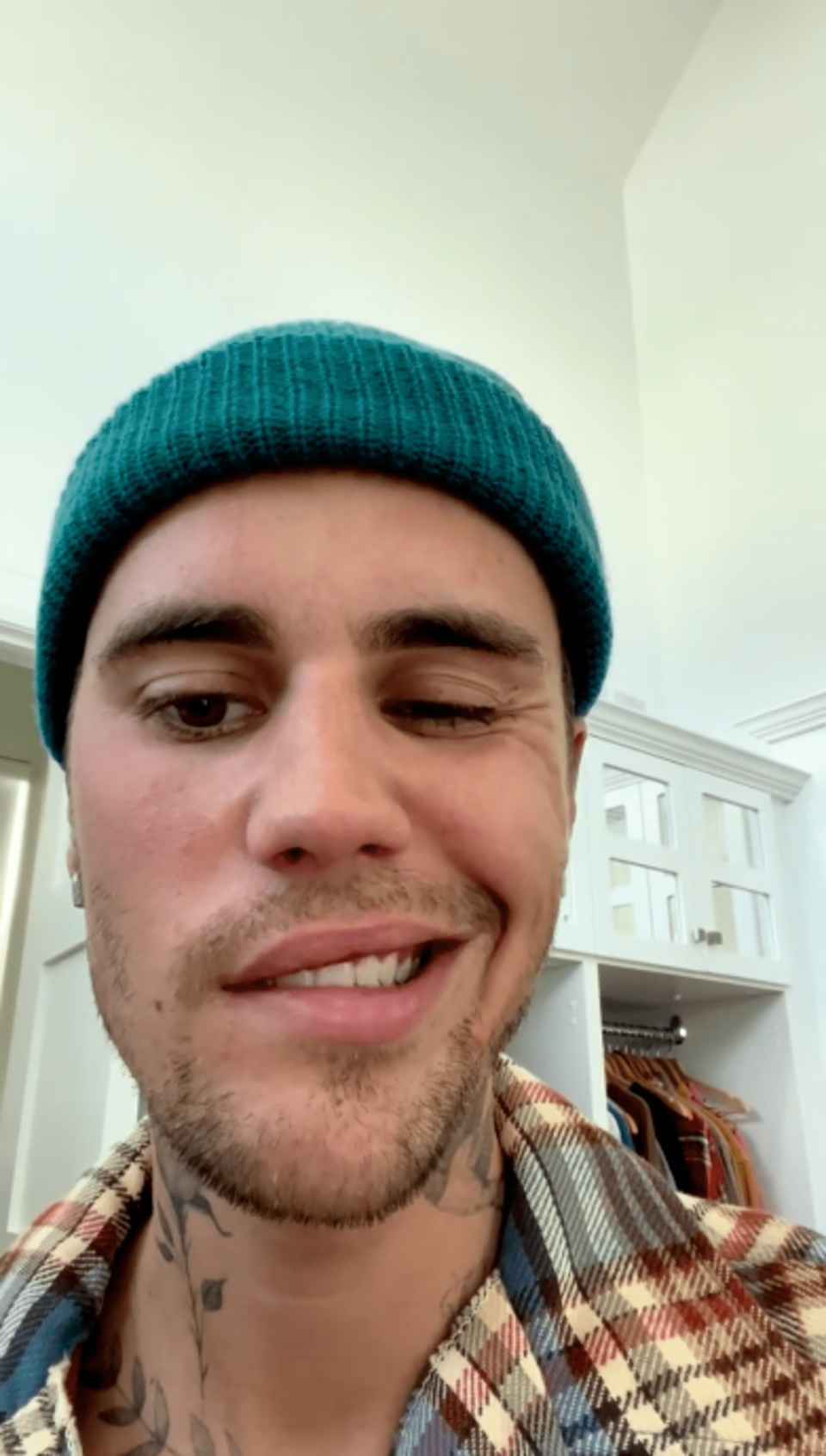 The singer showed how he could not move one side of his face during his June 2022 video. (Instagram/Justin Bieber)