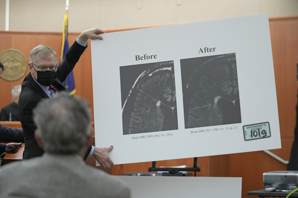 Paltrow attorney Steve Owens displays a poster showing a brain scan in the courtroom on Wednesday, March 29, 2023, in Park City, Utah. Paltrow's attorneys on Wednesday questioned medical experts about the injuries Terry Sanderson claims to have sustained when he and Paltrow collided at Deer Valley Resort seven years ago. (AP Photo/Rick Bowmer, Pool)