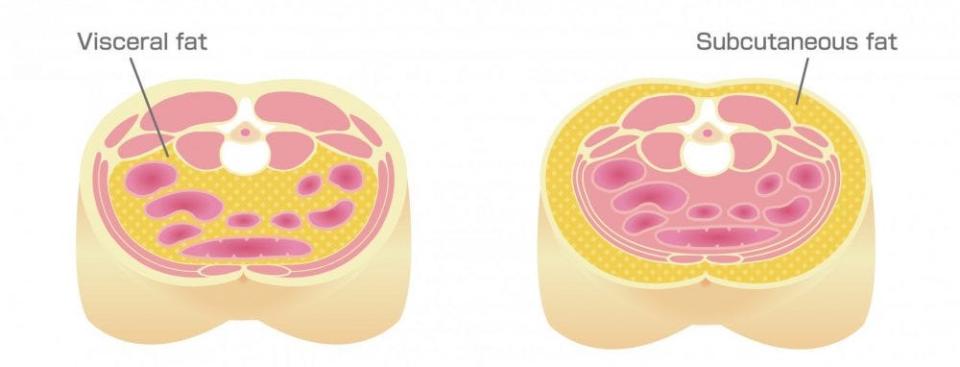 Visceral fat vs. subcutaneous fat