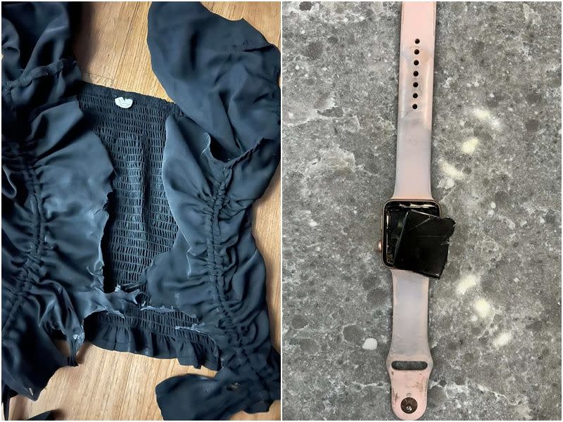 埃格勒穿的衣服被雷劈成兩半，連Apple Watch都爆炸。（翻攝自Erin Eggler臉書）