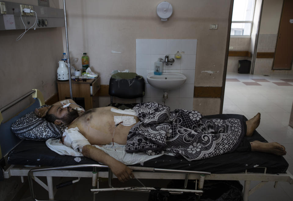 Mohammad Nassar, 31, rests at the Shifa hospital in Gaza City, Thursday, May 13, 2021, where he is receiving treatment for wounds caused by a May 12 Israeli strike that hit while he was driving a motorcycle. Just weeks ago, the Gaza Strip’s feeble health care system was struggling with a runaway surge of coronavirus cases. Now doctors across the crowded coastal enclave are trying to keep up with a very different crisis: blast and shrapnel wounds, cuts and amputations. (AP Photo/Khalil Hamra)