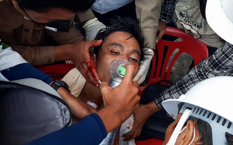 An injured man being treated by medical officials - AFP PHOTO /DAKKHINA INSIGHT via AFPTV