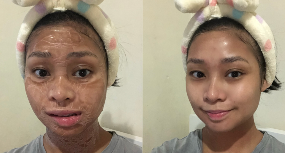 All-In-On Facial