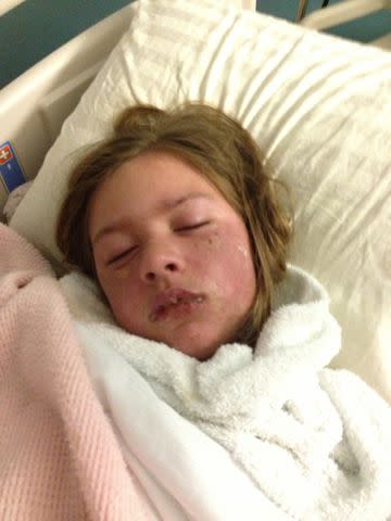 <p>Shriners Children's</p> Paige LaCombe at the hospital at 8 years old